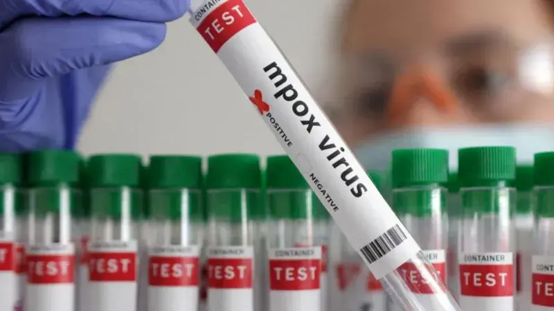 SENEGALESE AUTHORITIES REPORTS FIRST MPOX CASE OF THE YEAR